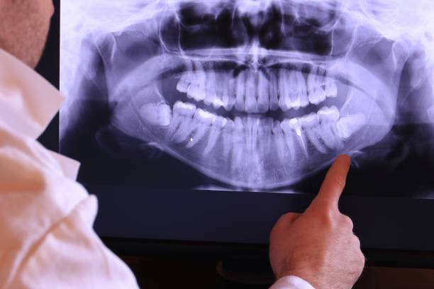 Best Emergency Treatment for Toothache in Lewiston, UT